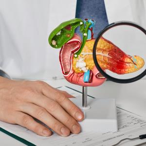 Indomethacin plus somatostatin helps avert pancreatitis in ERCP patients