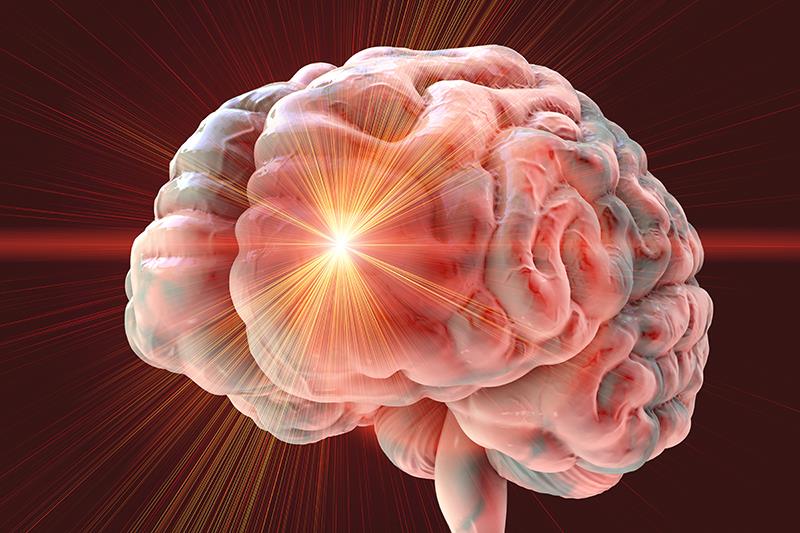 Propranolol lowers risk of ischaemic stroke in women with migraine
