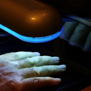 Phototherapy for psoriasis at home as good as in the office