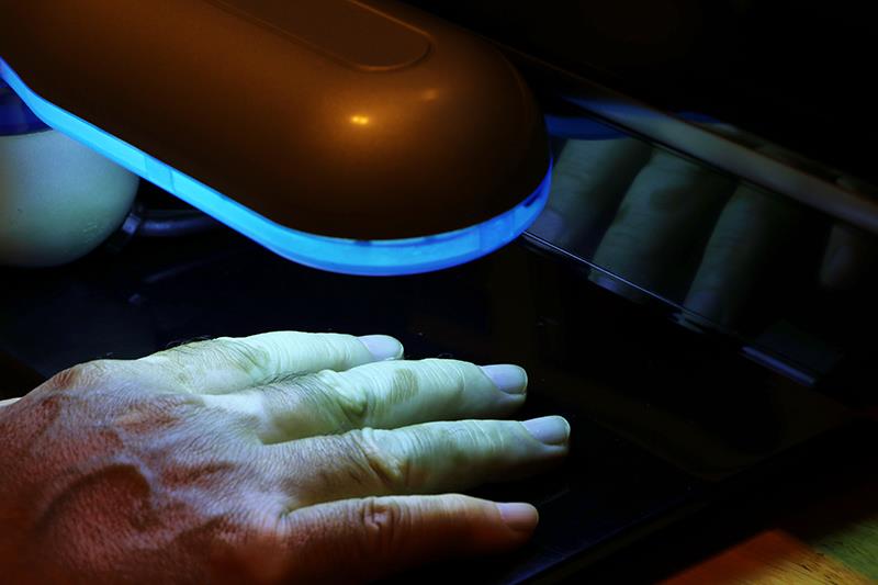 Phototherapy for psoriasis at home as good as in the office