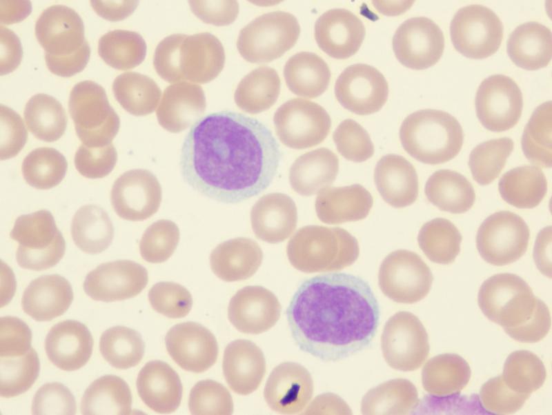 High-dose folic acid use ups risk of malignancy in women with childbirth experience