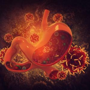 Second-line nivolumab for advanced OSCC benefits Asian patients