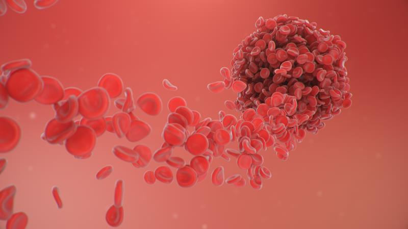 Bleeding common after acute coronary syndrome