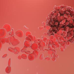 Low bleeding, VTE rates after 1-year edoxaban in real-world study