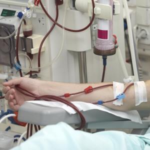 Regional citrate trumps systemic heparin for dialysis filter