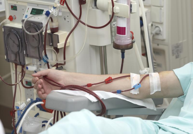 Dietary protein, exercise do not interfere with haemodialysis