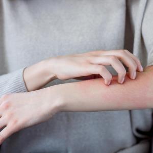 RELIEVE-AD: Atopic dermatitis patients see rapid, sustained improvements with dupilumab