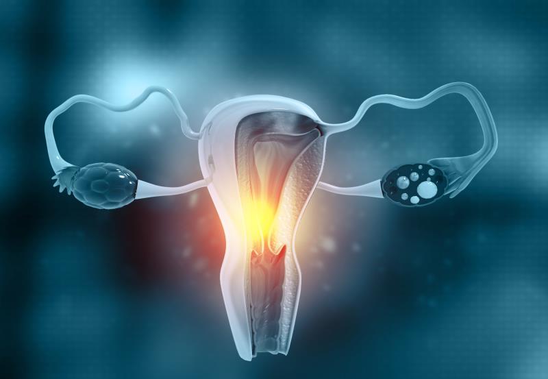 Reduction in endometriosis-associated pain sustained with relugolix combo therapy