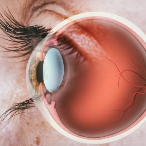 Can retinal thinning predict disability in MS?