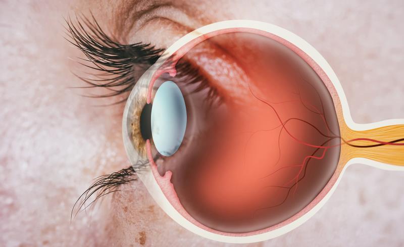 Can retinal thinning predict disability in MS?