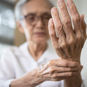 Upadacitinib proves long-term efficacy in RA