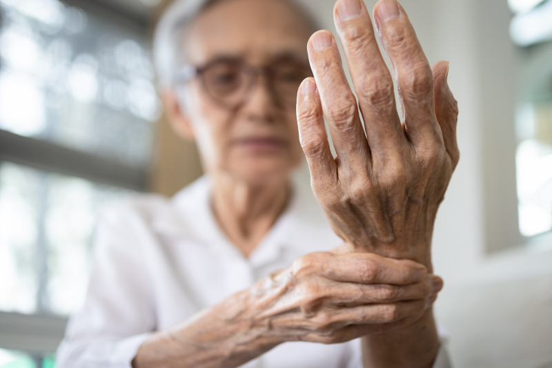 Upadacitinib proves long-term efficacy in RA