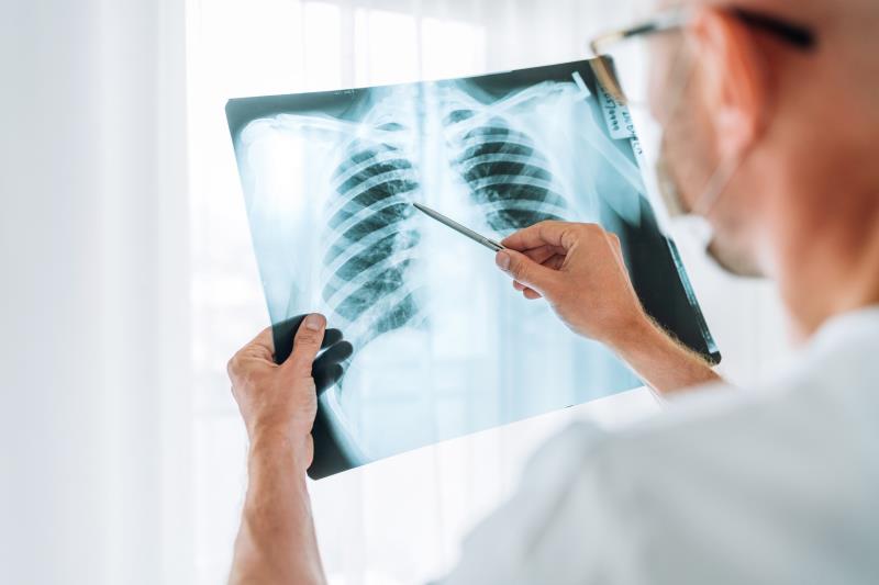 Shorter treatment regimen feasible for rifampin-resistant TB?