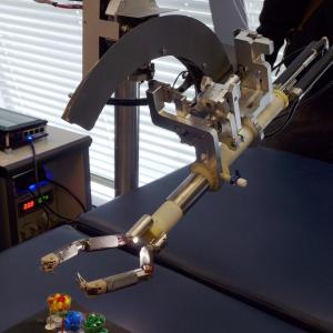 Robot-guided navigation feasible, highly accurate in spinal surgery