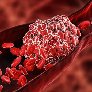 Role of apixaban in VTE management: Who, when, and how