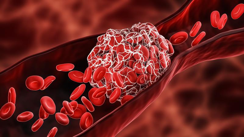 Role of apixaban in VTE management: Who, when, and how