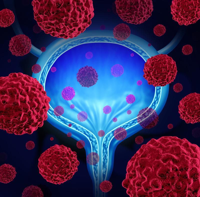 Cisplatin-based chemotherapy boosts survival in muscle-invasive bladder cancer