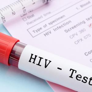 HIV testing, positivity rates decline during COVID-19 pandemic