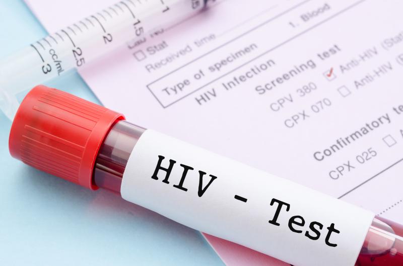 HIV testing, positivity rates decline during COVID-19 pandemic