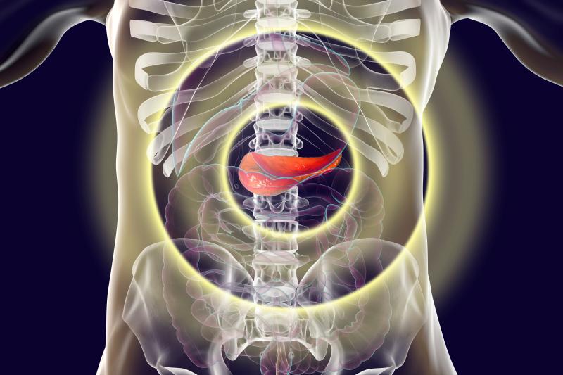 PPIs contribute to small increase in pancreatic cancer risk