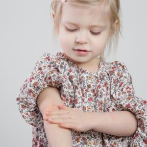 Secukinumab shows sustained improvement in paediatric psoriasis