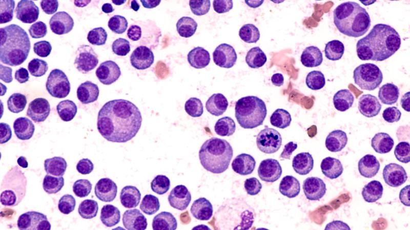 Multiple myeloma quadruplet prolongs survival, induces deeper responses