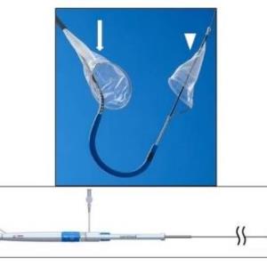 Novel filter device safe to use in patients undergoing TAVI