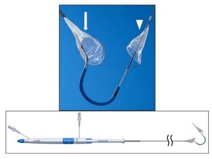 The SENTINEL cerebral protection system’s (a) filters, consisting of the proximal filter (arrow) and distal filter (arrowhead