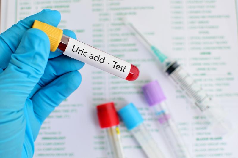 Higher serum uric acid translates to greater CV disease burden in chronic coronary syndromes