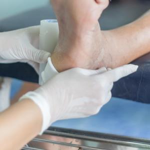 Diabetes-related foot ulceration hospitalization leads to lower hip, femoral BMD