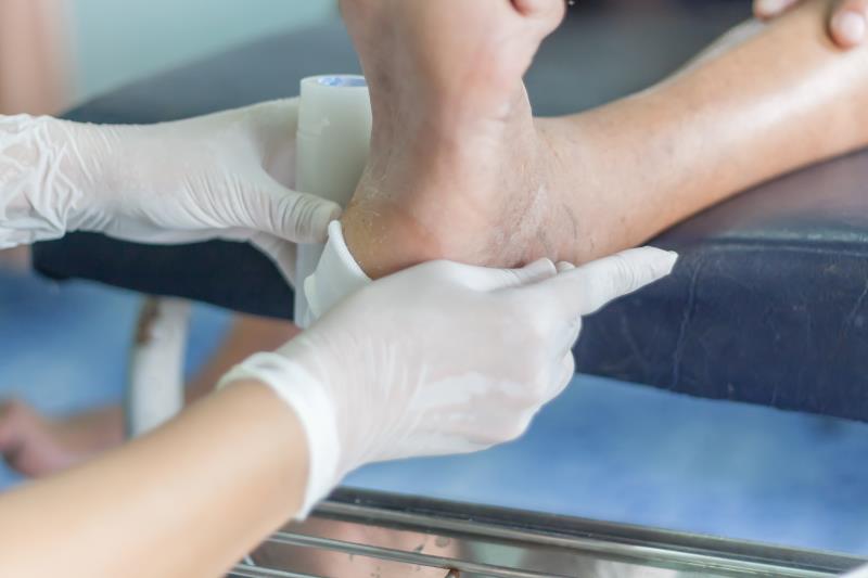 Diabetes-related foot ulceration hospitalization leads to lower hip, femoral BMD