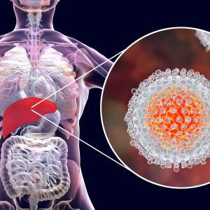 Psoriasis patients on biologics at risk of HBV, HCV reactivation