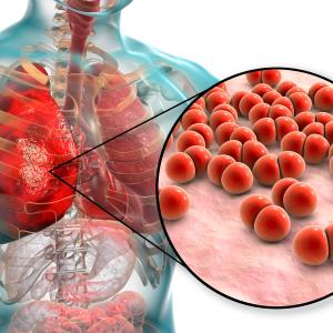 Should amoxicillin still be used for paediatric pneumonia?