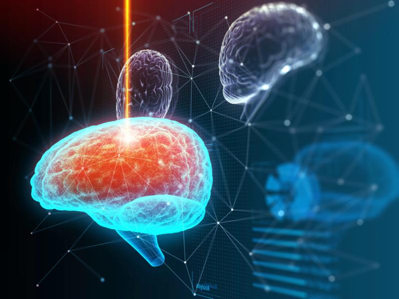 Hippocampal avoidance in WBRT better preserves cognitive function without compromising survival