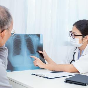 Flat-dose nivolumab well-tolerated, active for advanced NSCLC in Asians