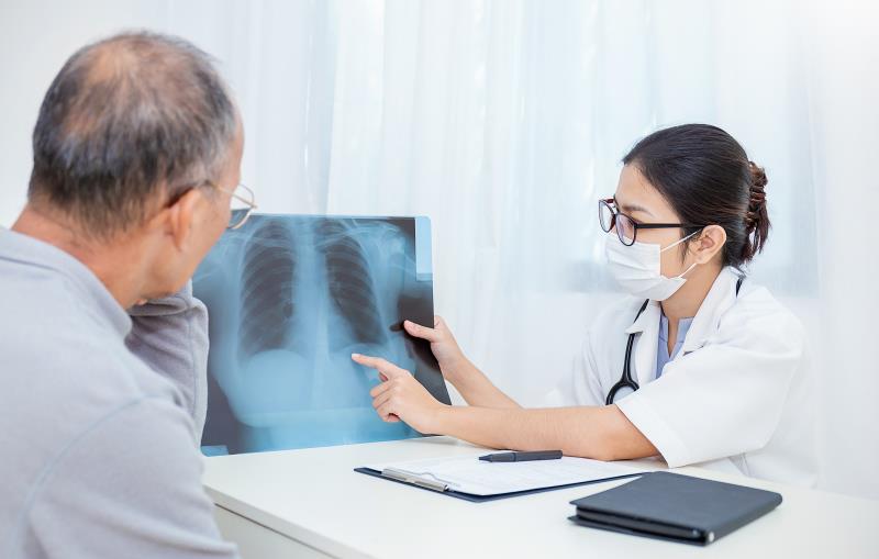 Flat-dose nivolumab well-tolerated, active for advanced NSCLC in Asians