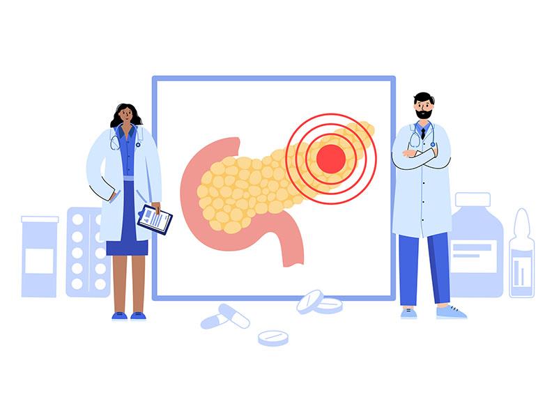 Oxaliplatin stop-and-go strategy provides similar PFS, OS vs 1st-line SoC in pancreatic cancer