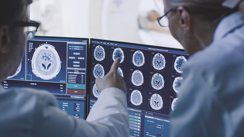 Stock image of a doctor and a radiologist discussing diagnosis while looking at brain MRI scans.