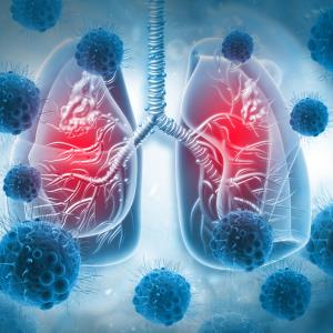 Multipathogen testing an essential part of Test-Target-Treat strategy for respiratory illnesses