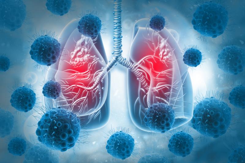 Multipathogen testing an essential part of Test-Target-Treat strategy for respiratory illnesses