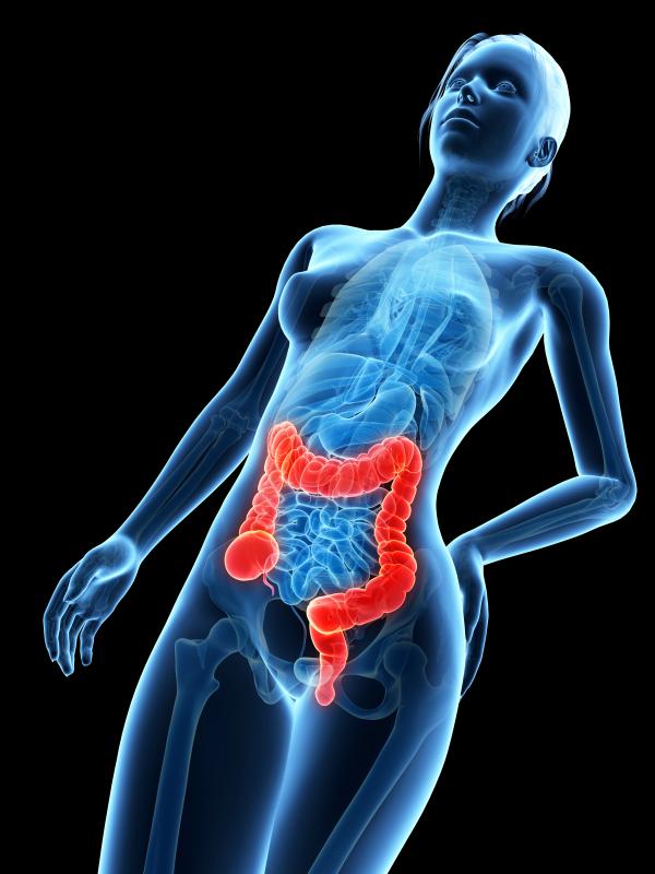 Apremilast may be beneficial to patients with active ulcerative colitis