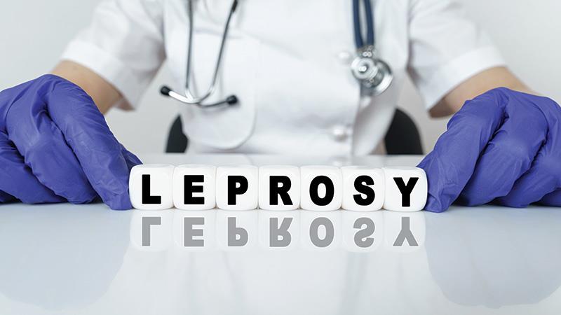 New study on leprosy reveals challenges, identifies potential solutions