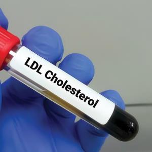 New cholesterol medication now available