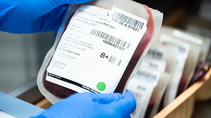 Patient blood management (PBM) has great potential to improve patient outcomes and as a corollary, reduce blood transfusion r