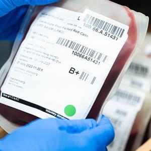 Cost savings gained with PBM may benefit patients with rare diseases