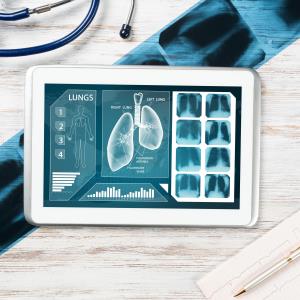 BPaLM regimen looks good for drug-resistant TB in children, adults
