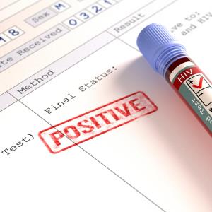 HIV-positive patients tend to receive less cardiovascular care