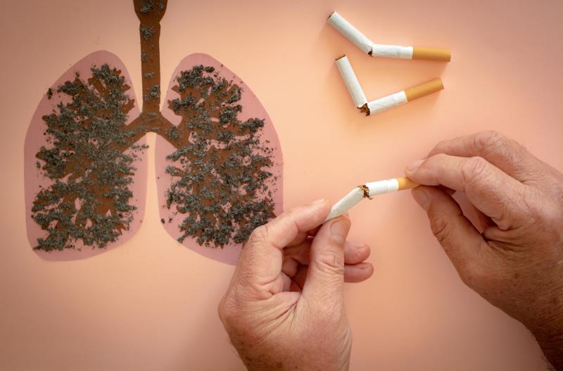 Smoking cessation intervention during lung screening may encourage quitting