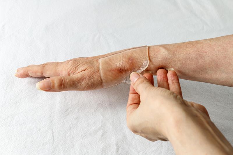 Some patients hesitant to perform self-wound care
