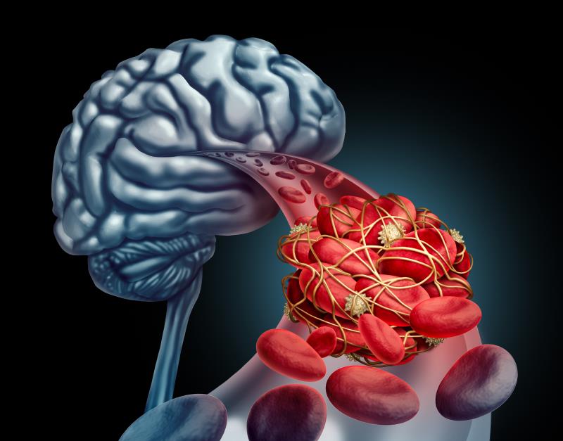 Endovascular therapy improves stroke outcomes in patients with prestroke disability